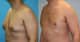 Slider image (10) Cancun Plastic Surgery Center by Dr. Víctor Sámano